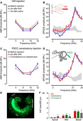 A Single Cisterna Magna Injection of AAV Leads to Binaural Transduction in Mice